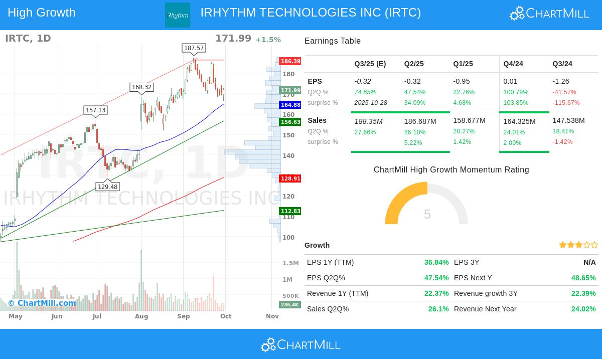 IRTC stock chart analysis
