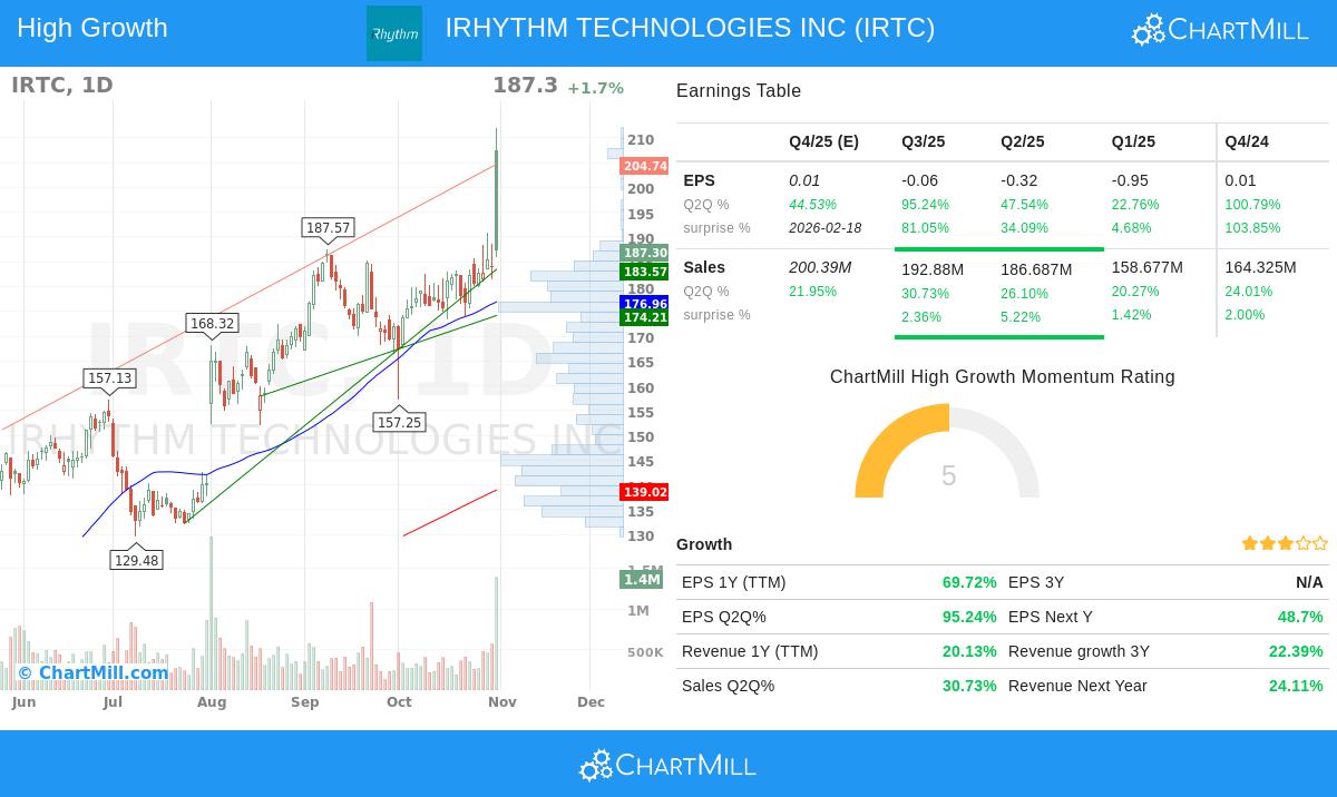 IRTC stock chart