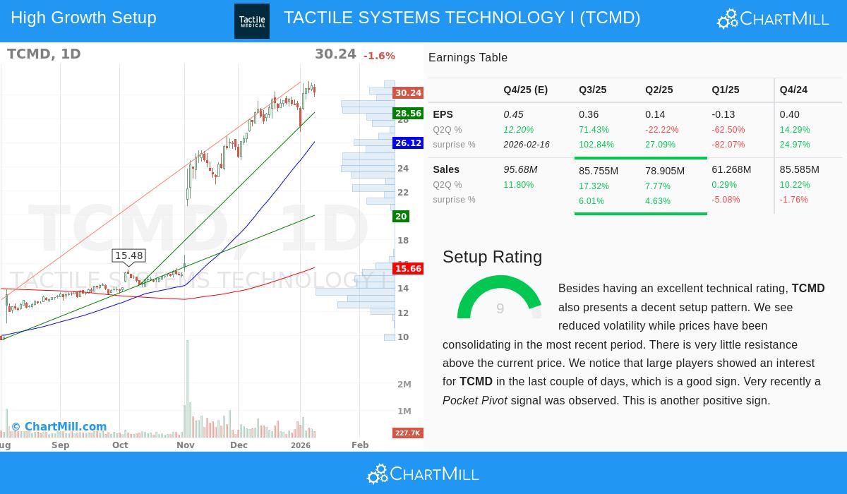TCMD Stock Chart