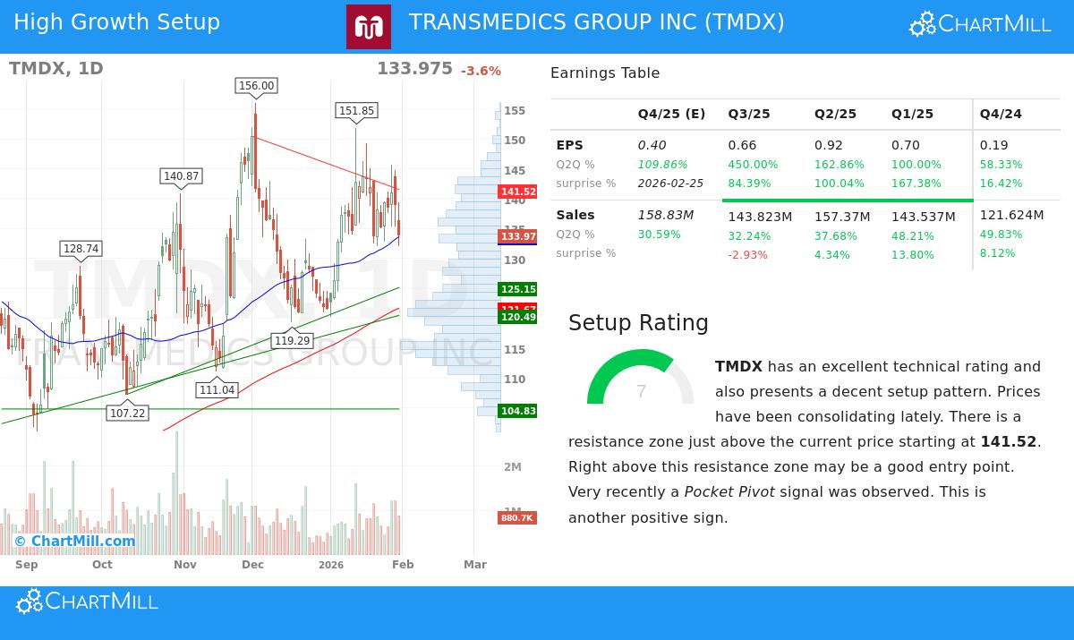 TransMedics Group Inc Stock Chart