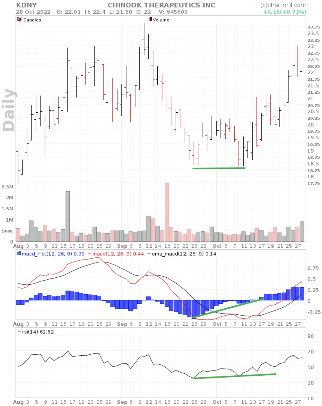 Double bottom divergences